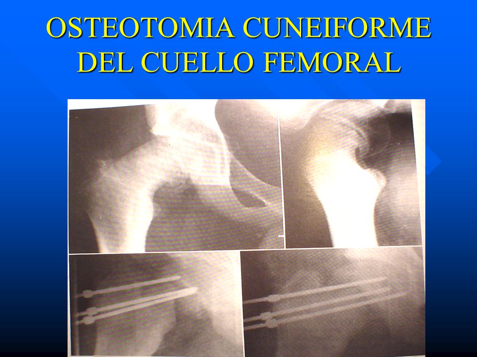 El dolor da en el hombro y en el cuello